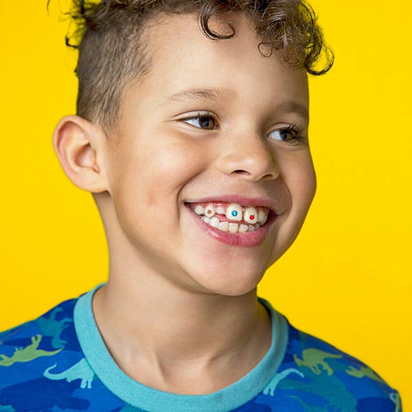  Curly haired child smiling with Invisalign stickables on his aligner