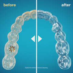 Invisalign™ Ultrasonic Cleaning Station