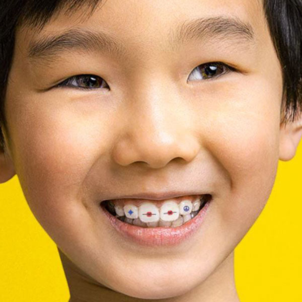 OrVance® Aligner Pontics | Invisalign Accessory Store