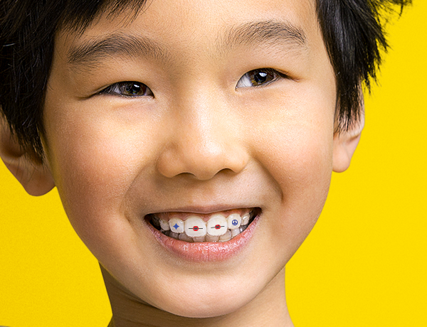 Cat Stickler Invisalign Invsialign Stickables™ Stickers | Invisalign Accessory Store